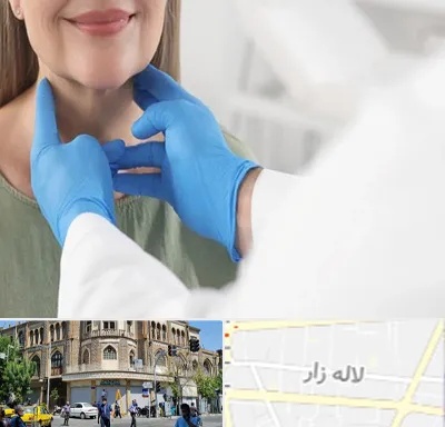 جراح سرطان گلو در لاله زار