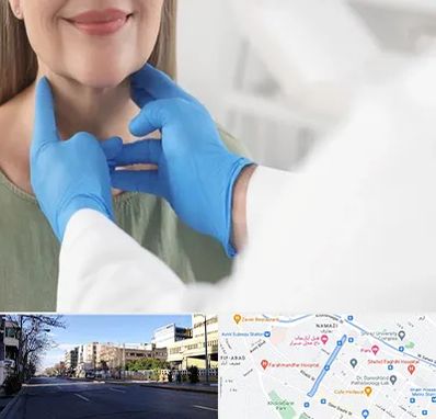 جراح سرطان گلو در خیابان ملاصدرا شیراز 