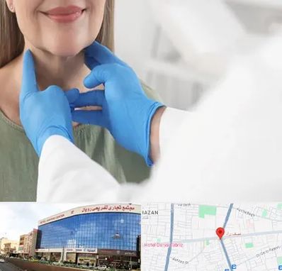 جراح سرطان گلو در نصف راه تبریز