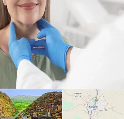 جراح سرطان گلو در کامیاران