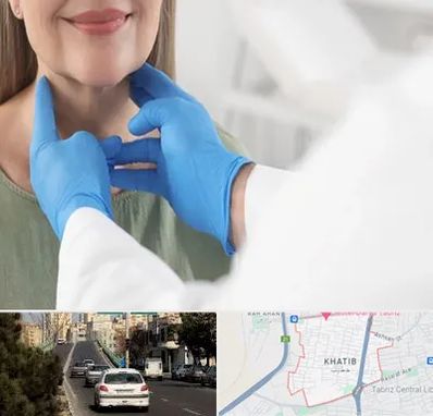 جراح سرطان گلو در خطیب تبریز