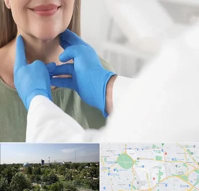 جراح سرطان گلو در منطقه 16 تهران 