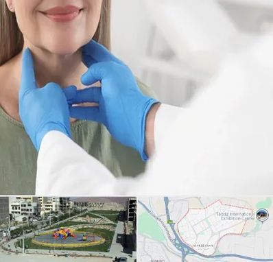 جراح سرطان گلو در مرزداران تبریز