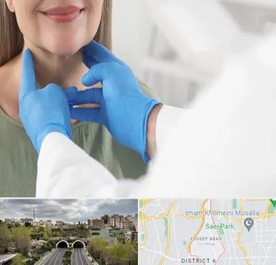 جراح سرطان گلو در یوسف آباد 