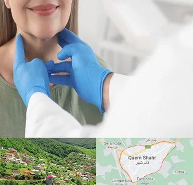 جراح سرطان گلو در قائم شهر