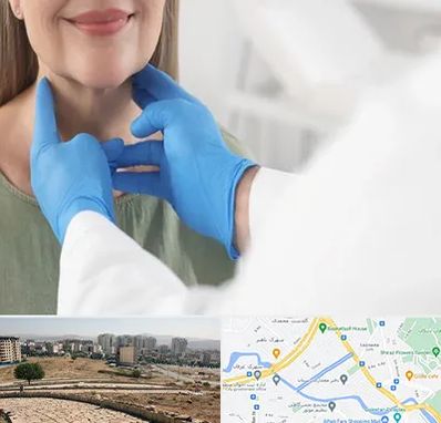 جراح سرطان گلو در کوی وحدت شیراز 