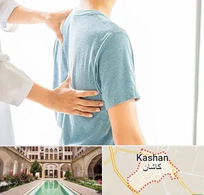 دکتر سیاتیک در کاشان