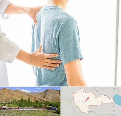 دکتر سیاتیک در خاش