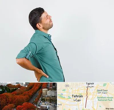 فوق تخصص عصب سیاتیک در ولیعصر 