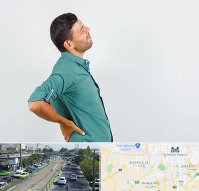 فوق تخصص عصب سیاتیک در جنوب تهران 