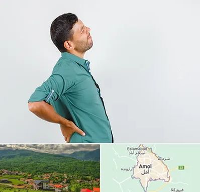 فوق تخصص عصب سیاتیک در آمل