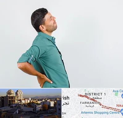 فوق تخصص عصب سیاتیک در فرمانیه 