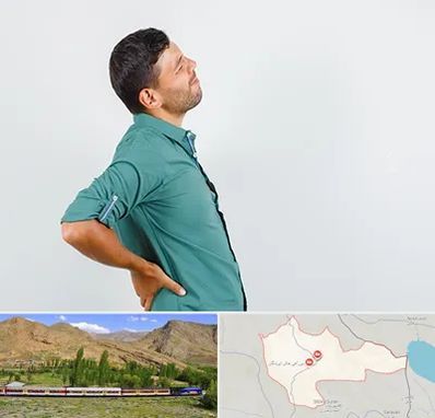 فوق تخصص عصب سیاتیک در خاش