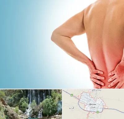 دکتر فلوشیپ دیسک کمر در شیروان