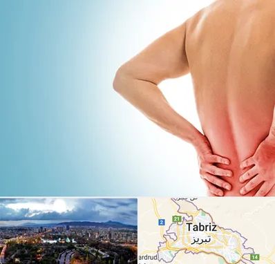 دکتر فلوشیپ دیسک کمر در تبریز