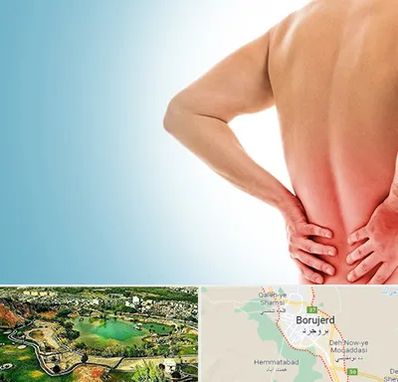 دکتر فلوشیپ دیسک کمر در بروجرد