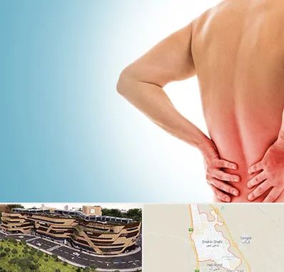 دکتر فلوشیپ دیسک کمر در شاهین شهر