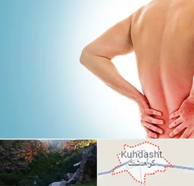 دکتر فلوشیپ دیسک کمر در کوهدشت