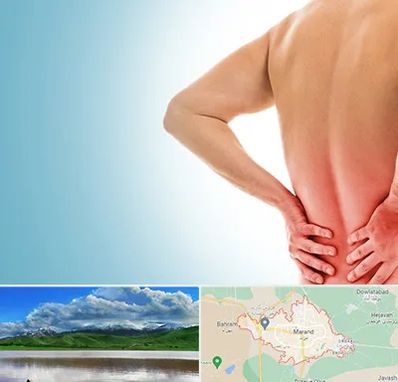 دکتر فلوشیپ دیسک کمر در مرند