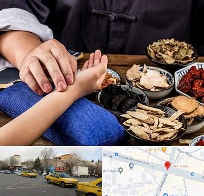 دکتر گیاهی در شهناز تبریز