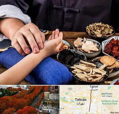 دکتر گیاهی در ولیعصر 