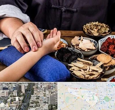 دکتر گیاهی در منطقه 18 تهران 