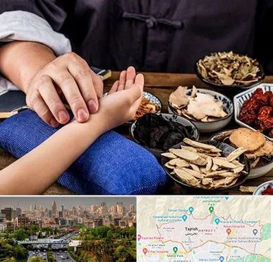 دکتر گیاهی در منطقه 1 تهران 