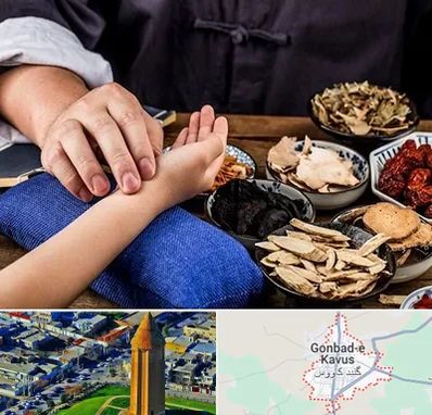 دکتر گیاهی در گنبد کاووس