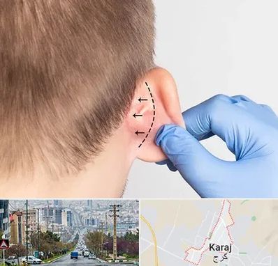 عمل زیبایی گوش در گوهردشت