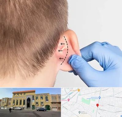 عمل زیبایی گوش در زنبیل آباد قم