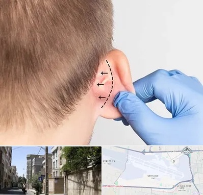 عمل زیبایی گوش در مهرآباد