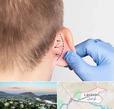 عمل زیبایی گوش در لواسان