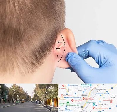 عمل زیبایی گوش در شریعتی