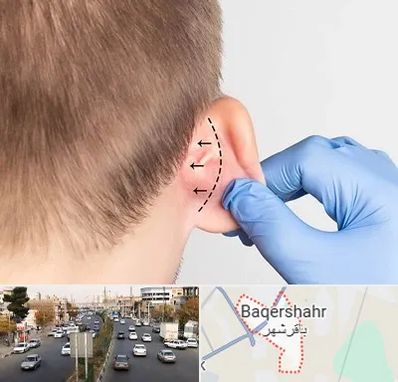 عمل زیبایی گوش در باقرشهر