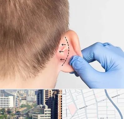 عمل زیبایی گوش در خیابان بهشتی