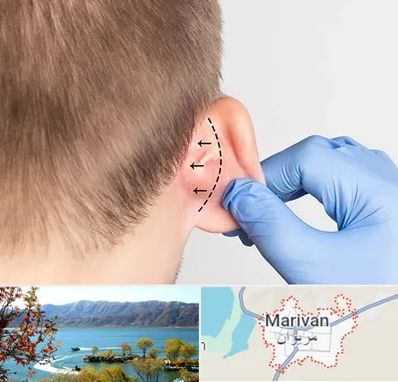 عمل زیبایی گوش در مریوان