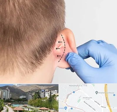 عمل زیبایی گوش در شهر زیبا