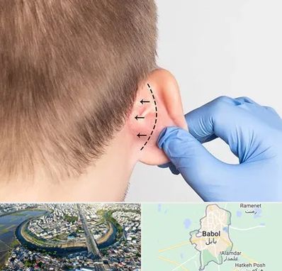 عمل زیبایی گوش در بابل