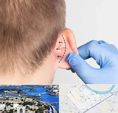 عمل زیبایی گوش در کوروش اهواز