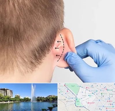 عمل زیبایی گوش در کوهسنگی مشهد