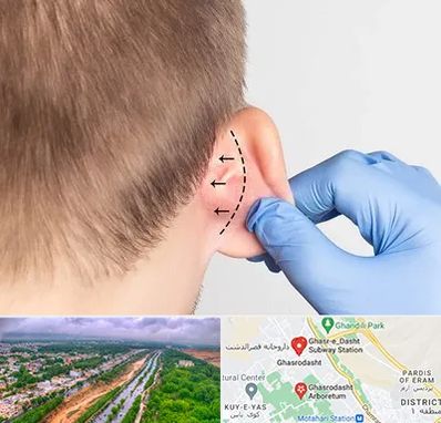 عمل زیبایی گوش در قصرالدشت شیراز