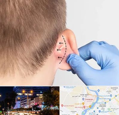 عمل زیبایی گوش در کیانپارس اهواز