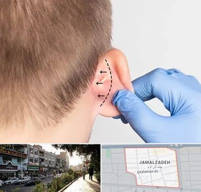 عمل زیبایی گوش در خیابان جمالزاده
