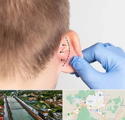 عمل زیبایی گوش در مراغه