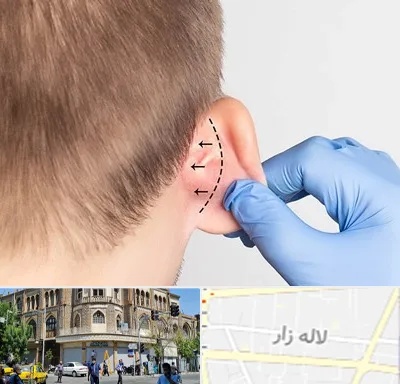 عمل زیبایی گوش در لاله زار