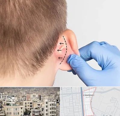 عمل زیبایی گوش در اسکندری