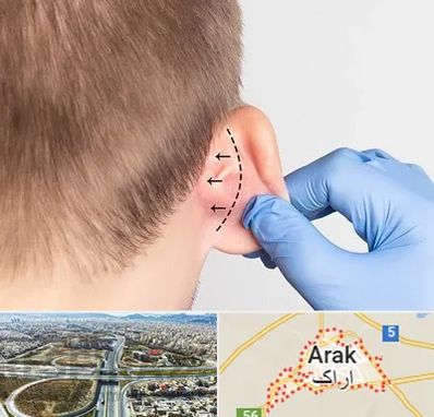 عمل زیبایی گوش در اراک