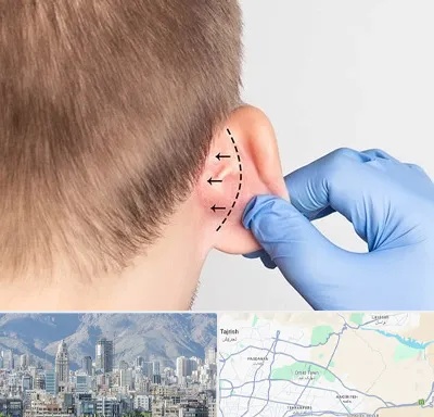 عمل زیبایی گوش در شمال شرق تهران
