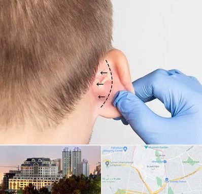 عمل زیبایی گوش در فرشته