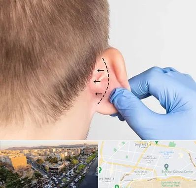 عمل زیبایی گوش در تهرانپارس تهران